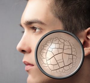 A magnifying glass is placed over the cheek of a handsome young man, shown in profile. The magnified image shows a dry and cracked surface, implying a lack of moisture in the skin.